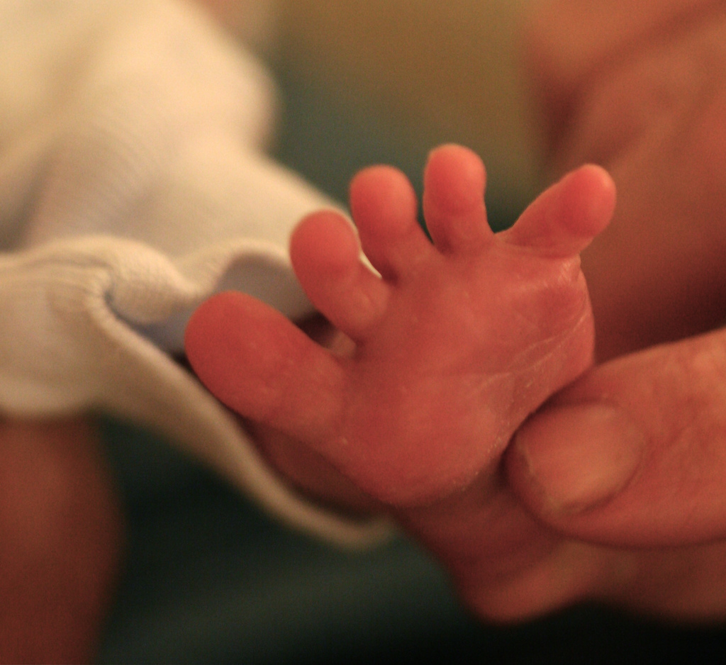 Хватательный рефлекс стопы. Хватательный тип стопы. Конечности хватательного типа. Хватательный рефлекс робинсона. Хватательный тип стопы.